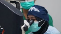 RSUD Ploso Sukses Gelar Operasi Katarak Gratis: 80 Pasien Kembali Bisa Melihat